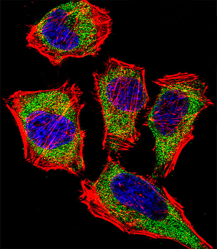 CA2 Antibody (N-term)