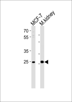 CA2 Antibody (N-term)