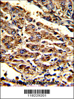 HOMER1 Antibody (N-term)