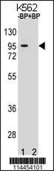 MIC1 Antibody (Center)