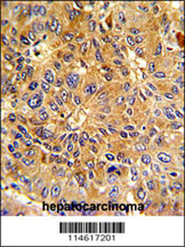 Cyclin A (CCNA2) Antibody (N-term)