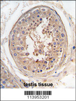 JLP (SPAG9) Antibody (Center)
