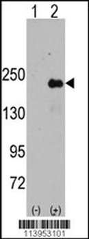 JLP (SPAG9) Antibody (Center)