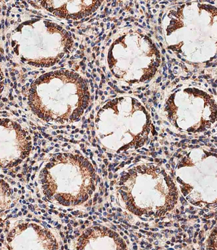 PHB2 Antibody (Y248)