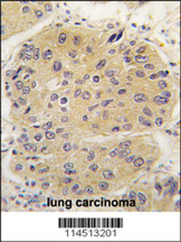 EIF4A1 Antibody (N-term)