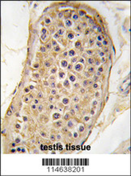 RICTOR Antibody (N-term)