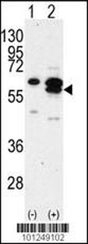 CAMK1G (CaMKI gamma) Antibody (C-term)