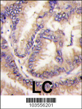 CDKL5 (STK9) Antibody (C-term)