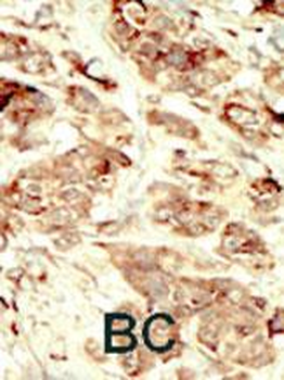 STK35 Antibody (Center)