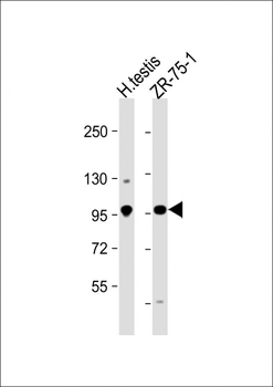 STK31 Antibody (C-term)