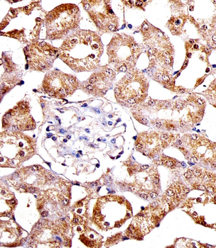 SPHK1 Antibody (N-term P74)