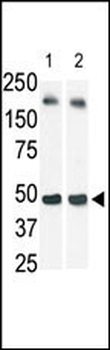 SPHK1 Antibody (N-term)