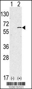 SPHK1 Antibody (N-term)