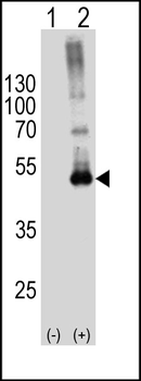 SPHK1 Antibody (N-term)