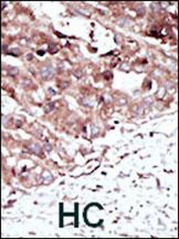 PHKG2 Antibody (N-term)