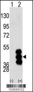 PHKG2 Antibody (N-term)