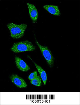 DAPK1 Antibody (C-term)