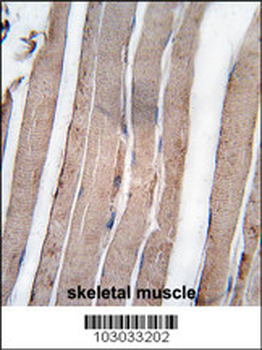 DAPK1 Antibody (C-term)