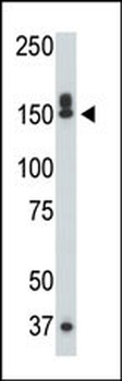 DAPK1 Antibody (C-term)