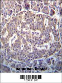 SCYL1 Antibody (N-term)