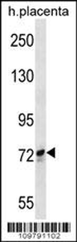 SCYL1 Antibody (N-term)