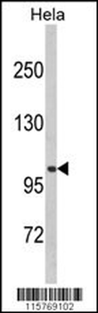 CASK Antibody (Center K227)