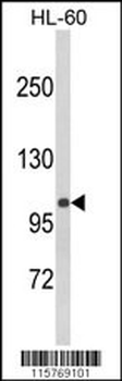 CASK Antibody (Center K227)