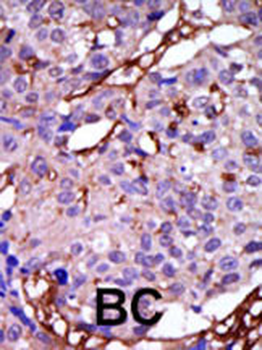 CASK Antibody (C-term)