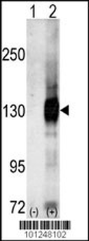 CASK Antibody (C-term)