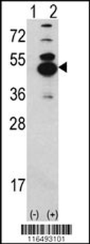 CAMK1D Antibody (N-term)