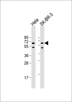 AMPK alpha 1 Antibody (C-term)