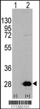 HSP27 (HSPB1) Antibody (S78)