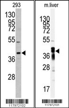 AKR7A2 Antibody (N-term)