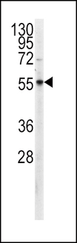 PKM2 Antibody (C-term C474)