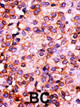 PANK3 Antibody (N-term)