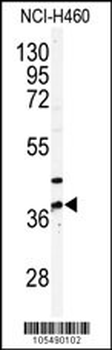 PANK3 Antibody (N-term)