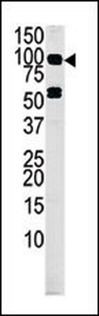 MARK4 Antibody (C-term)