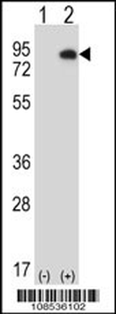 HIPK4 Antibody (C-term)