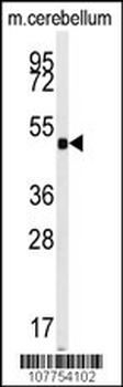 Guanylyl Cyclase alpha 2 (GUCY1A2) Antibody (N-term)