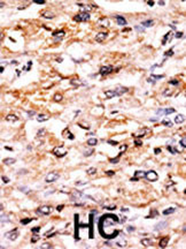 GCN2 Antibody (N-term G11)