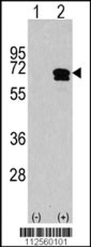 CAMKK2 Antibody (C-term)