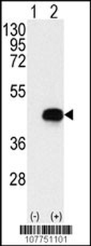 BCKDK Antibody (Center)