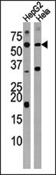 Activin A Receptor Type IC (ACVR1C) Antibody (N-term A48)