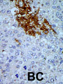 PNCK Antibody (C-term)