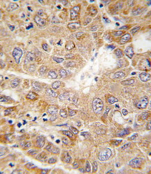 PGK1 Antibody (Center)