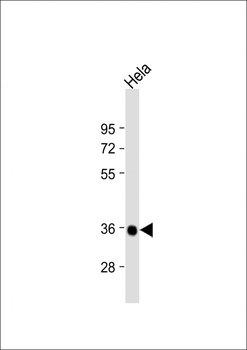 Deoxyguanosine Kinase (DGUOK) Antibody (C-term)