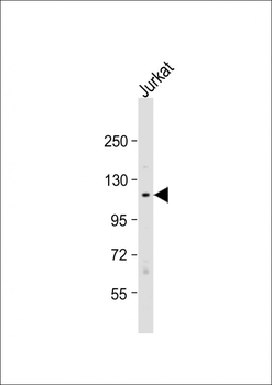 TAOK1 Antibody (Center)