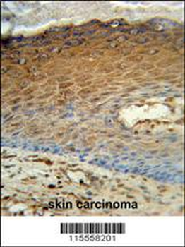 AK7 Antibody (C-term)