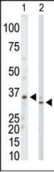 PRPS1/PRPS2/PRPS3 Antibody (N-term)