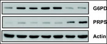 PRPS1/PRPS2/PRPS3 Antibody (N-term)